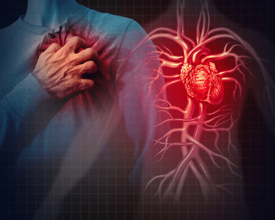 cardiovascular disease